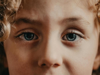 Bambine dagli occhi belli: cos&#039;è la sindrome di Rett, disturbo neurologico femminile